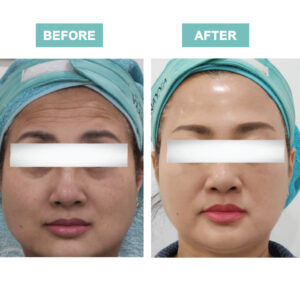 SKIN BOOSTER ULTRA HYDRATING