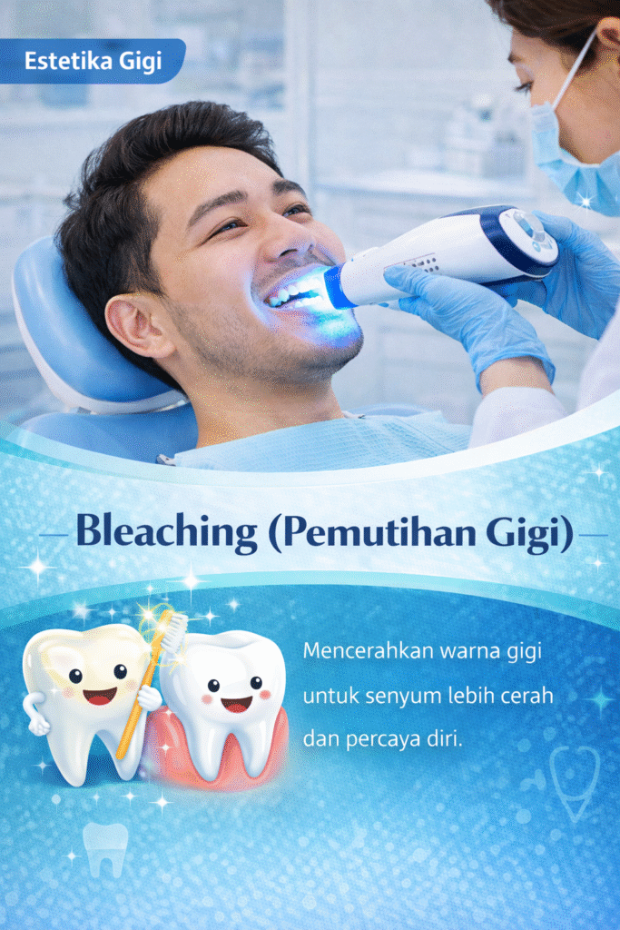 Bleaching (Pemutihan Gigi)