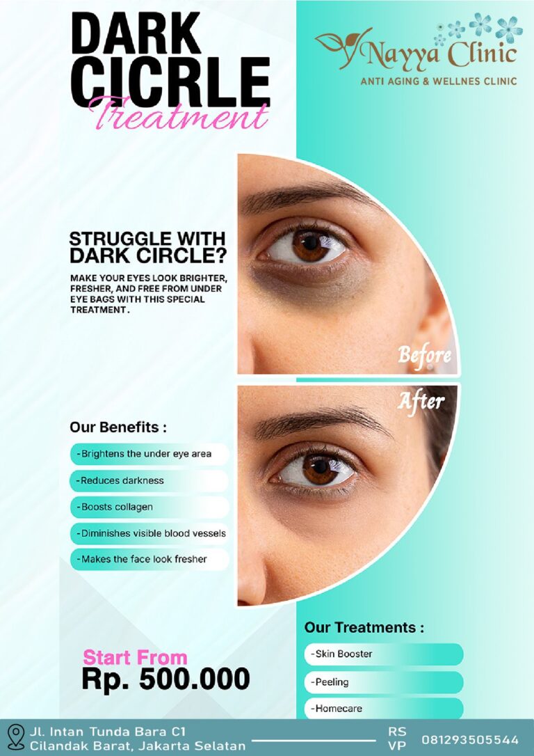 Dark Circle Treatment