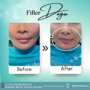 WhatsApp Image 2025-12-12 at 12.17.01 (2)