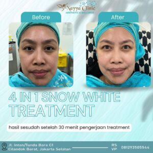 WhatsApp Image 2026-02-19 at 11.38.13 (2)